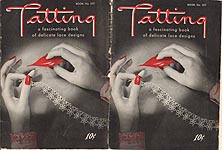 Book No. 207: Tatting